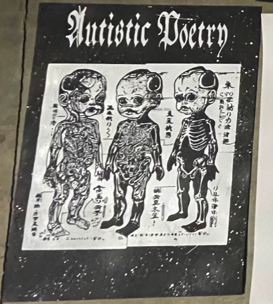 Dylan Stewart - "AP Fetus"