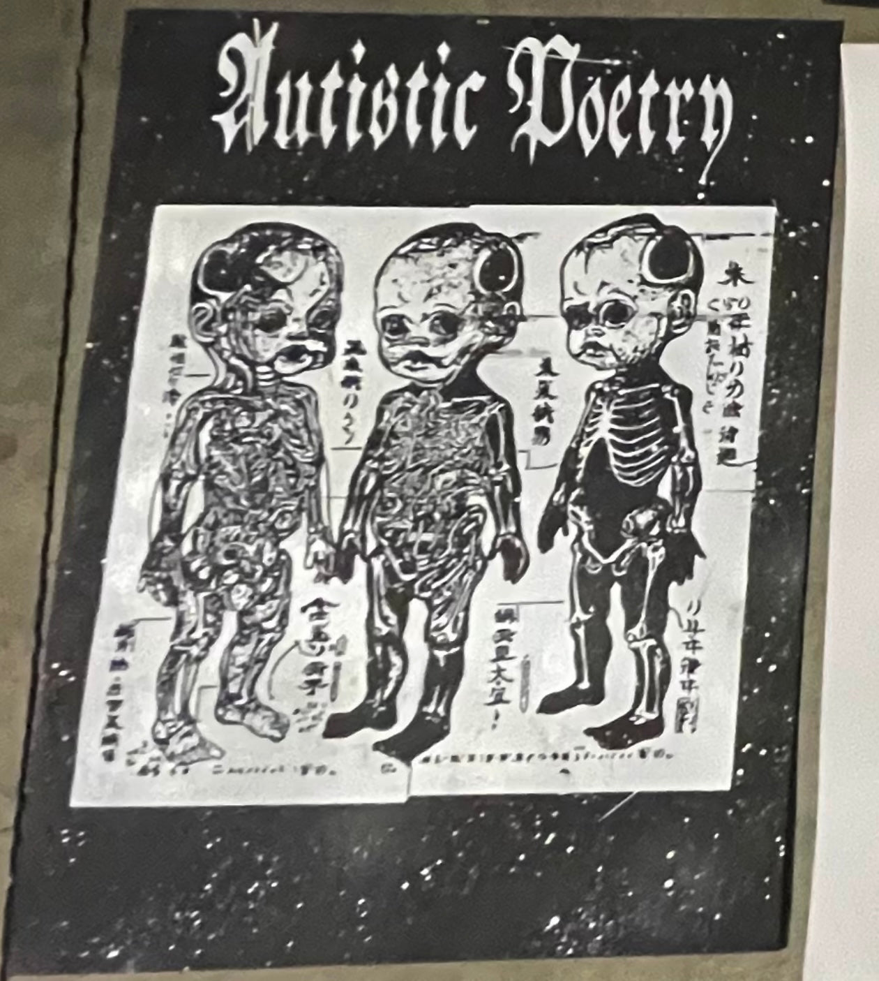 Dylan Stewart - "AP Fetus"